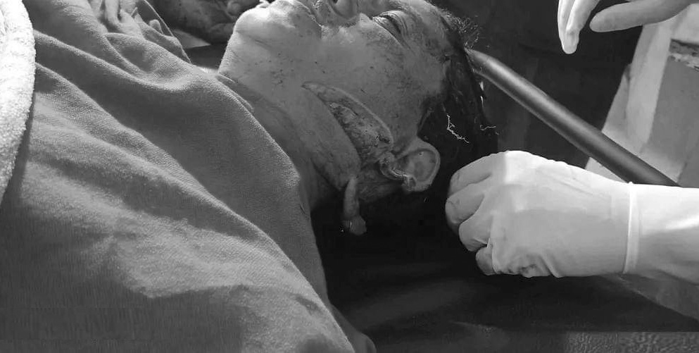 सल्यानमा नन्दद्वारा भाउजू माथि धारिलो हतियार प्रहार